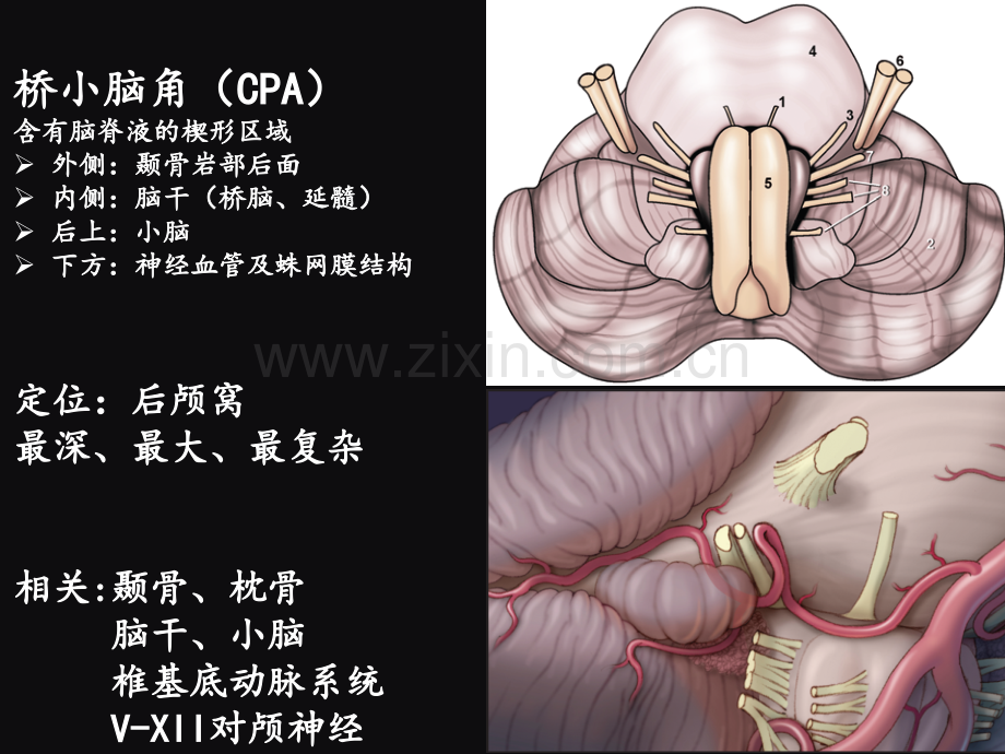 桥小脑角相关解剖PART-1.ppt_第3页