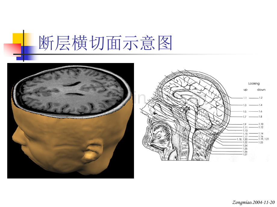 脑磁共振局部解剖与功能图谱-(1).ppt_第3页