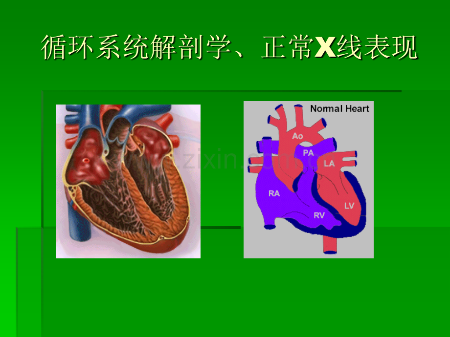 胸部心脏的X线诊断(ppt文档).ppt_第3页