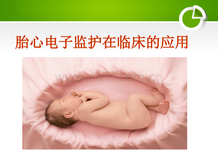 胎心监护-(1).ppt_第1页