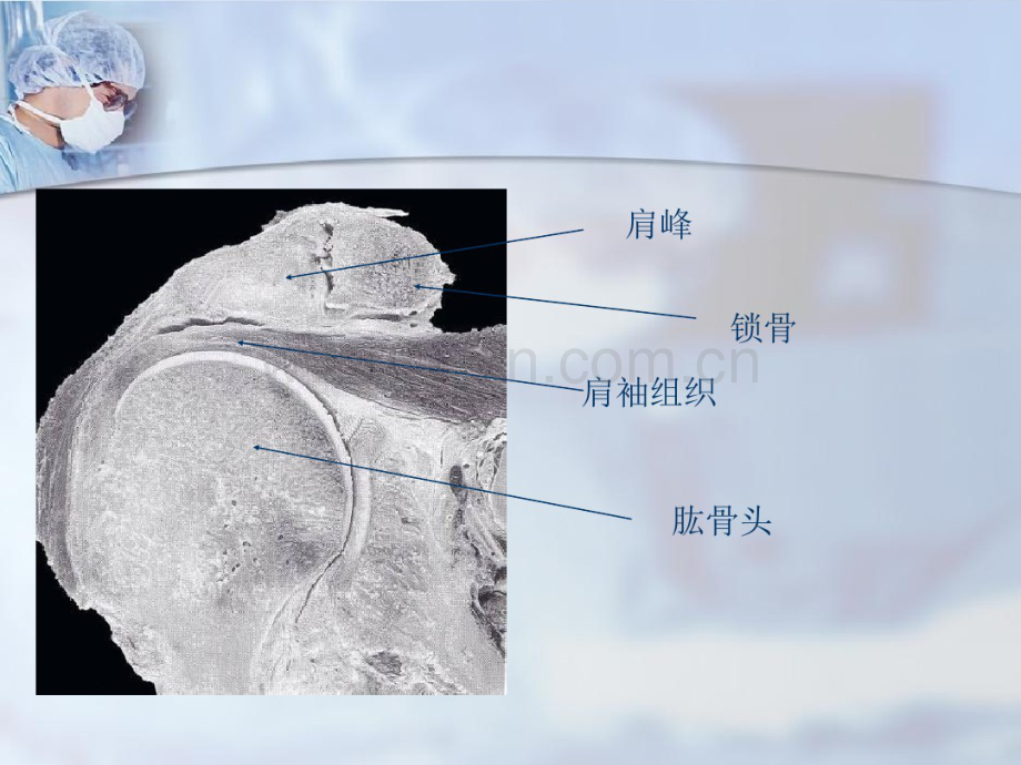 RCT肩关节镜-(2).pdf_第2页