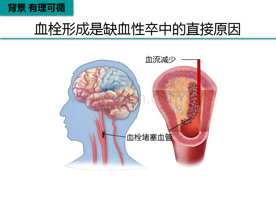 脑梗死再灌注治疗.pdf_第3页