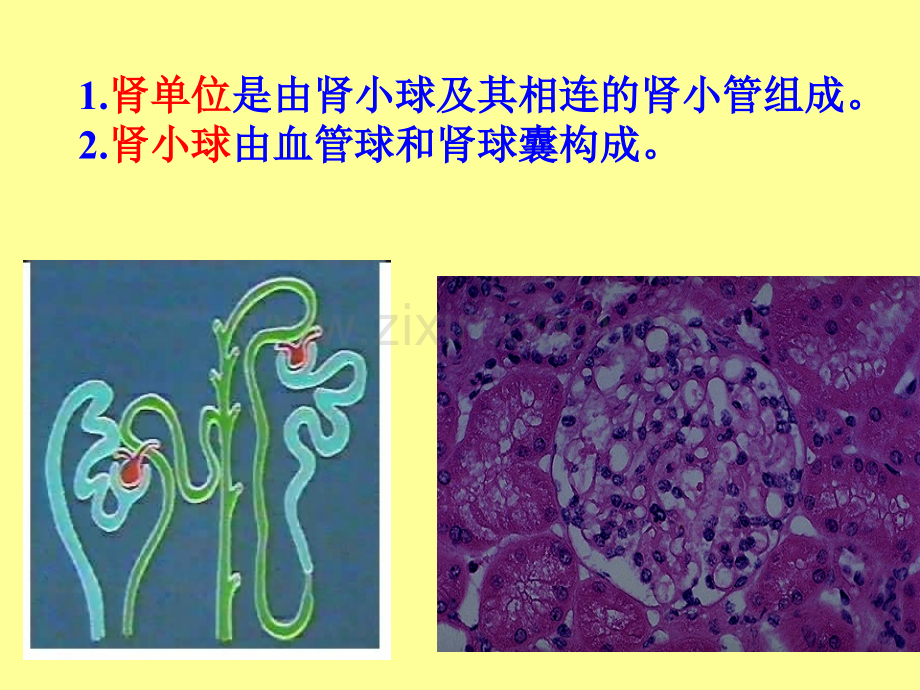 病理学第八章泌尿系统疾病.ppt_第3页