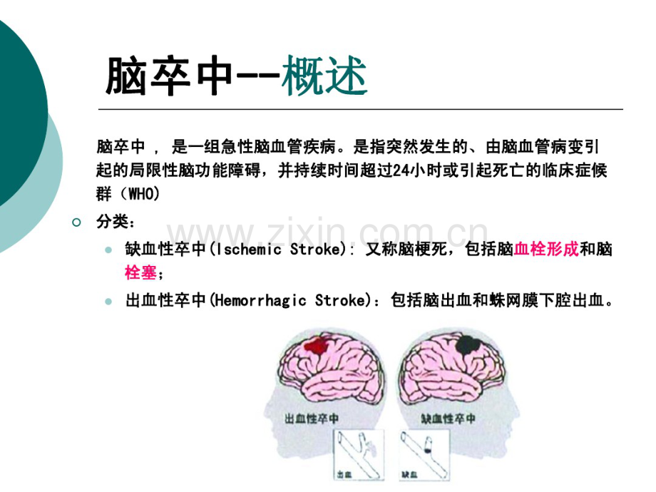 脑卒中后的偏瘫康复及预防(20190912215940).pdf_第2页