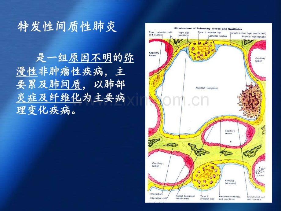 特发性间质性肺炎病理特征及分类(2015).pdf_第2页