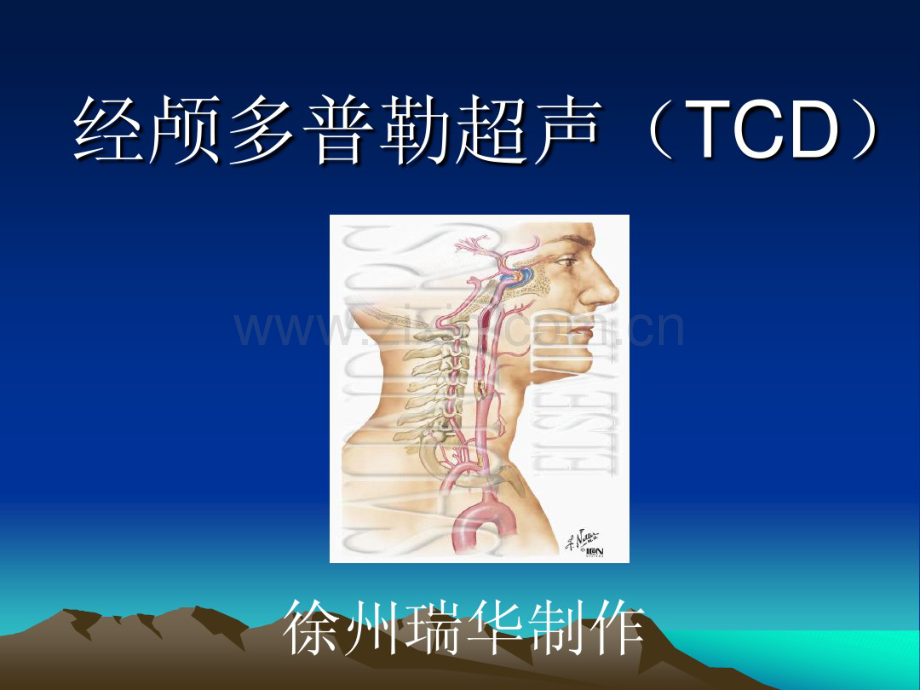 瑞华公司经颅多普勒(TCD)讲解.pdf_第1页