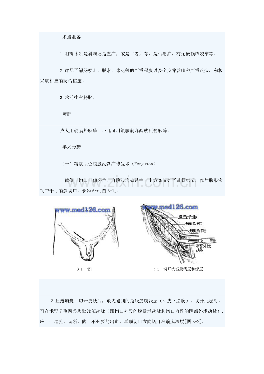 一般腹股沟斜疝手术步骤修复术.doc_第3页