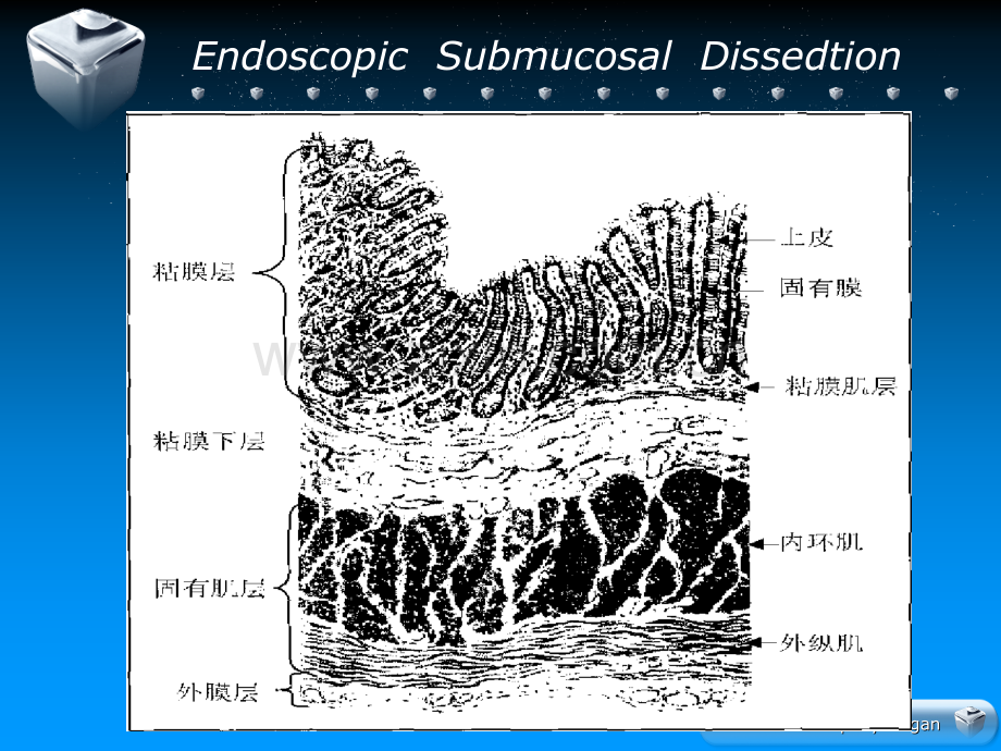 ESD的手术配合.ppt_第3页