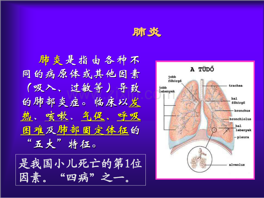 儿科肺炎.ppt_第2页