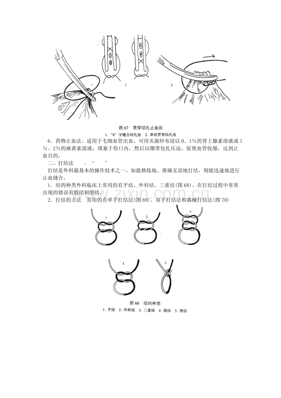 外科手术(止血、缝合、打结和绷带技术(图)).doc_第2页