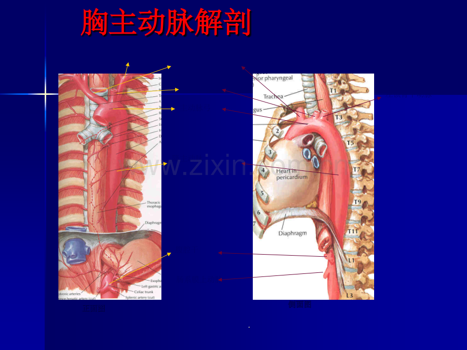 主动脉夹层及腹主动脉瘤CTA影像.ppt_第2页