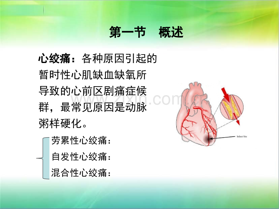 23第二十三章-抗心绞痛药物医学PPT课件.ppt_第2页