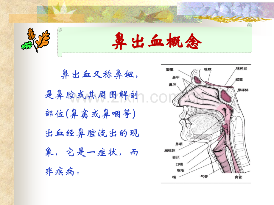 课件鼻出血(3)医学PPT课件.ppt_第3页