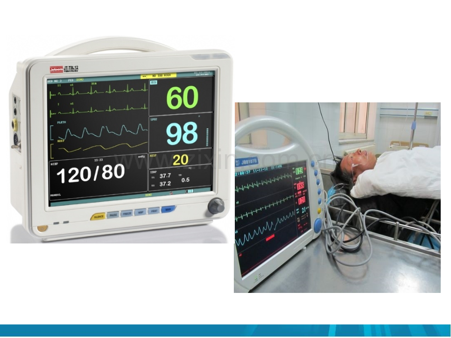 2017心电监护相关知识培训.ppt_第2页