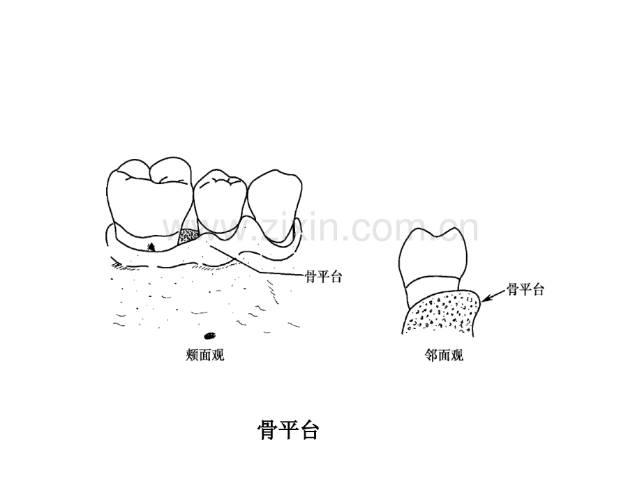 牙-周-病-学-第四版-4.ppt_第1页