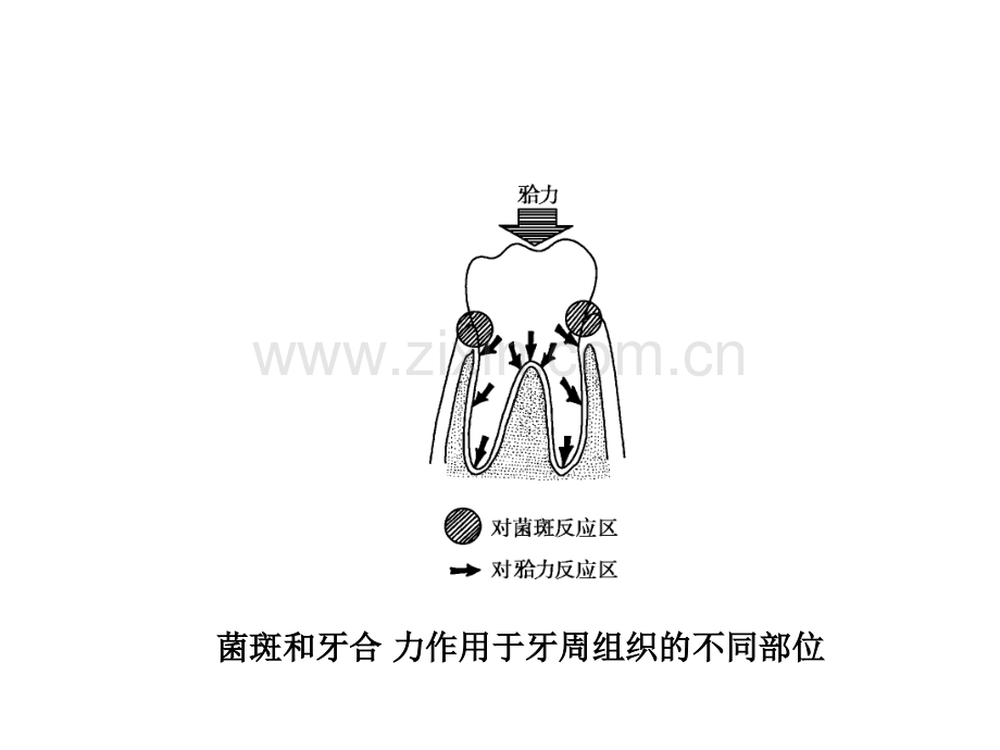 牙-周-病-学-第四版-4.ppt_第2页