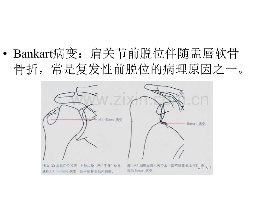 特殊名称骨折俱乐部.ppt_第3页