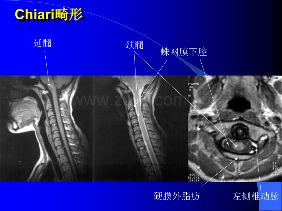 脑部疾病MRI图像A.ppt_第1页