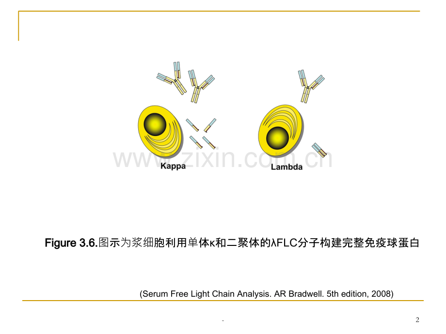 浆细胞瘤.ppt_第2页