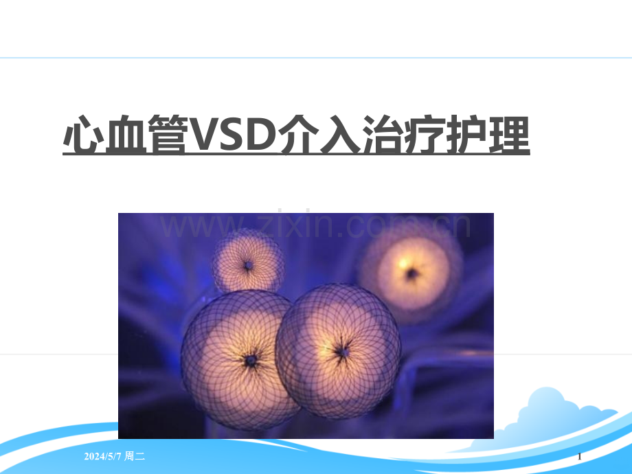 VSD介入术前术后护理.ppt_第1页