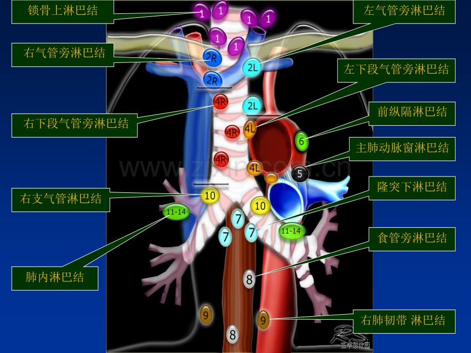 肺癌纵膈肺门淋巴结分区及CT图像.ppt_第3页