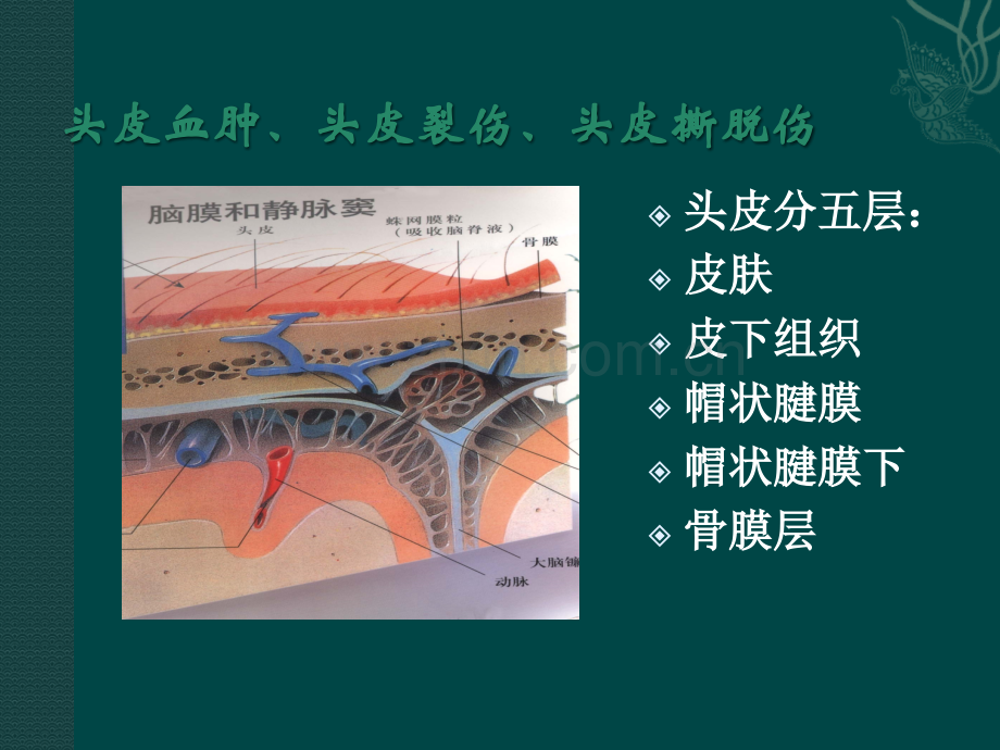 颅脑损伤病人的护.ppt_第3页