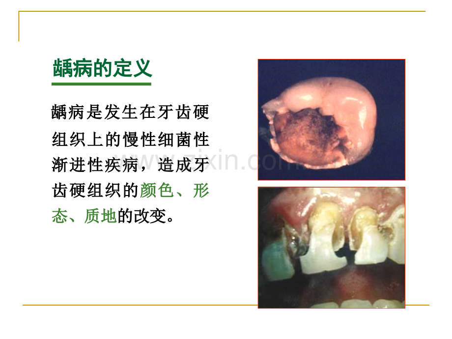 【医学课件】牙体牙髓病微生物学.ppt_第3页