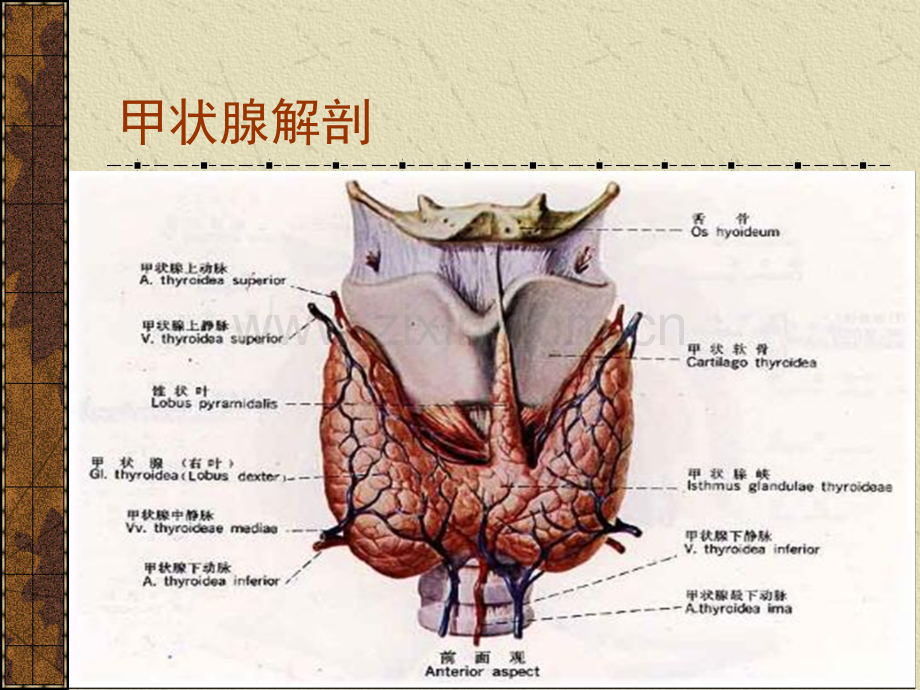 甲状腺炎分类及诊治.ppt_第2页