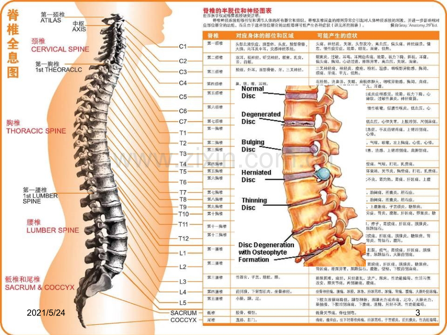 人工搬运分析.ppt_第3页