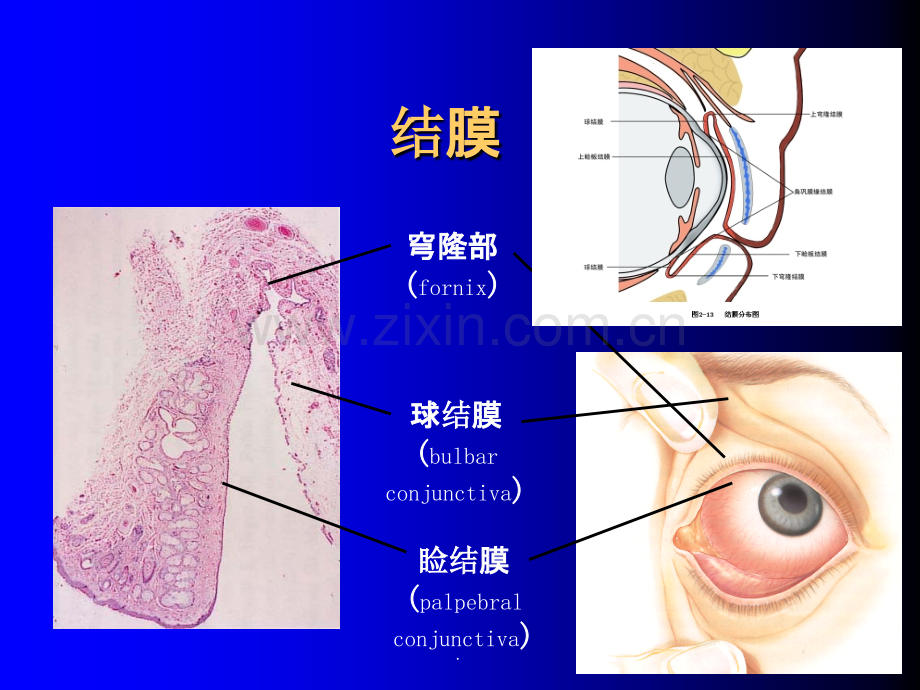 结膜病清晰课件.ppt_第2页