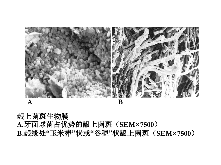 牙-周-病-学-第四版-3.ppt_第1页