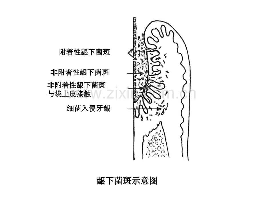 牙-周-病-学-第四版-3.ppt_第2页