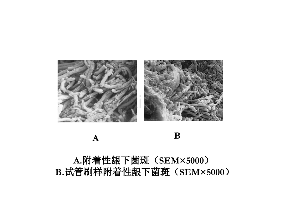 牙-周-病-学-第四版-3.ppt_第3页