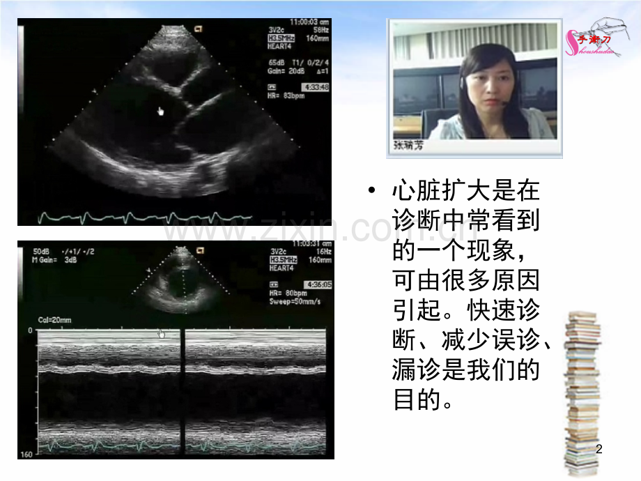 心脏扩大的超声诊断思路.ppt_第2页