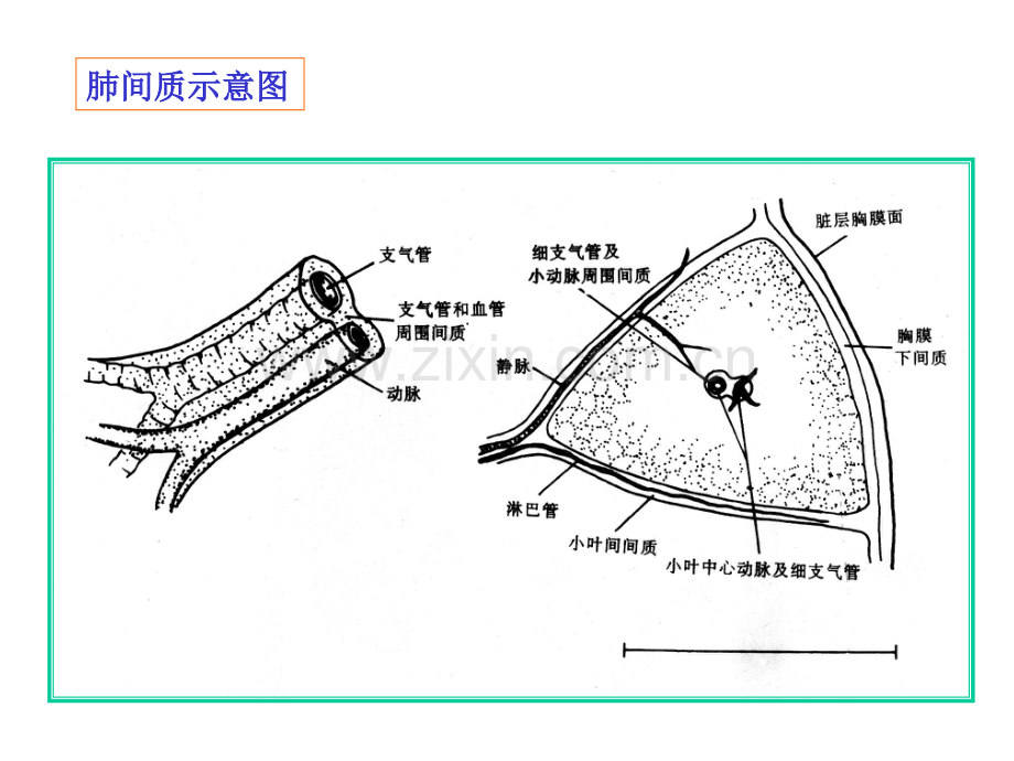 肺间质性病变改.ppt_第2页