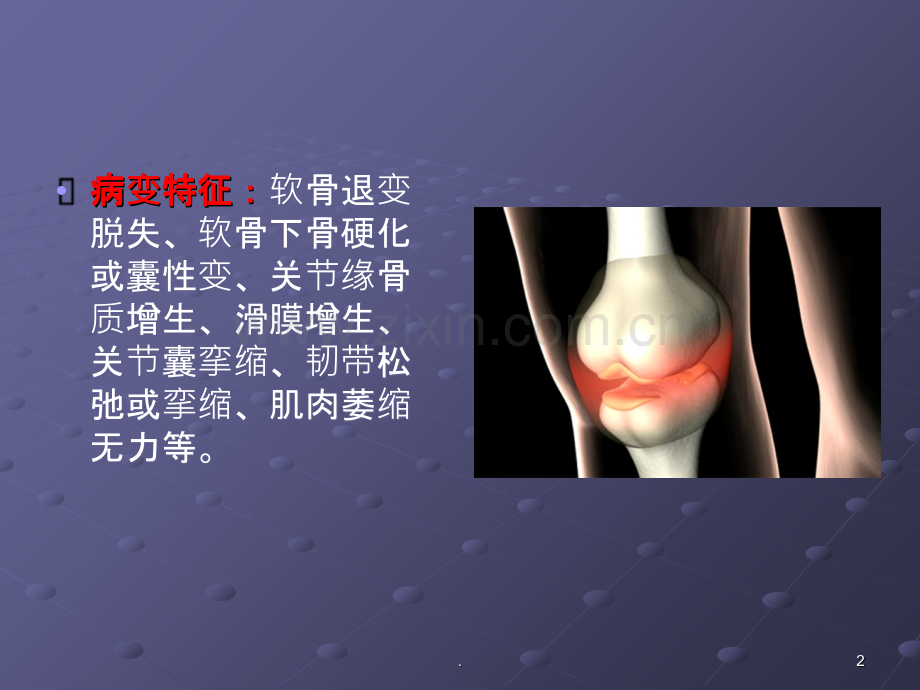 骨性关节炎.ppt_第2页