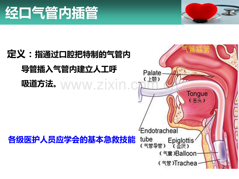 经口气管内插管.ppt_第2页