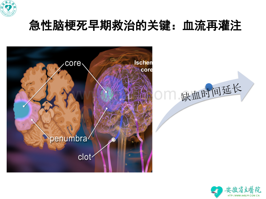 急性脑梗死静脉溶栓指南解读（培训）——神经内科.ppt_第3页