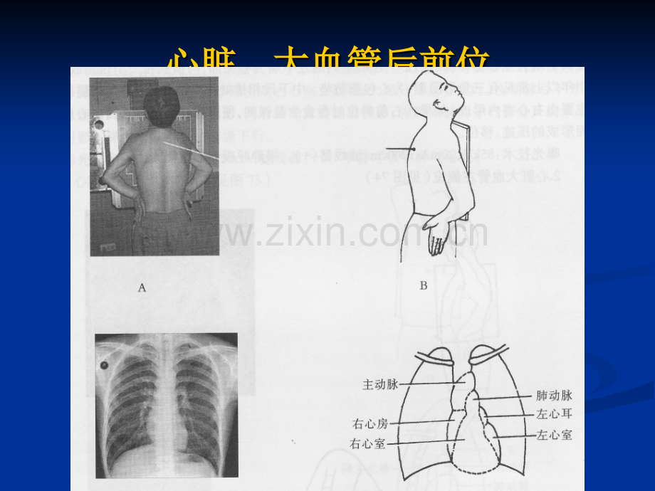 特殊摄影.ppt_第2页