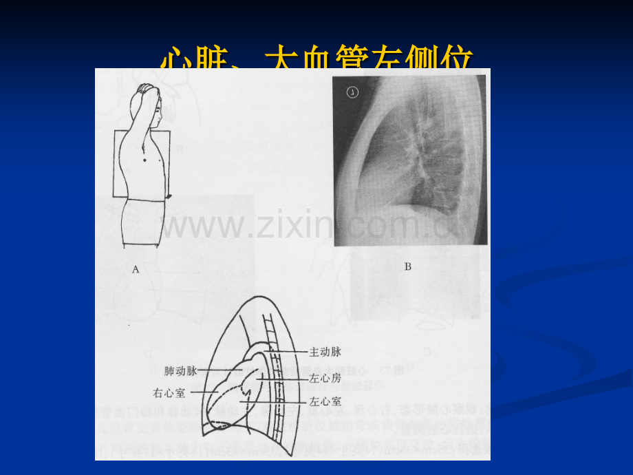 特殊摄影.ppt_第3页