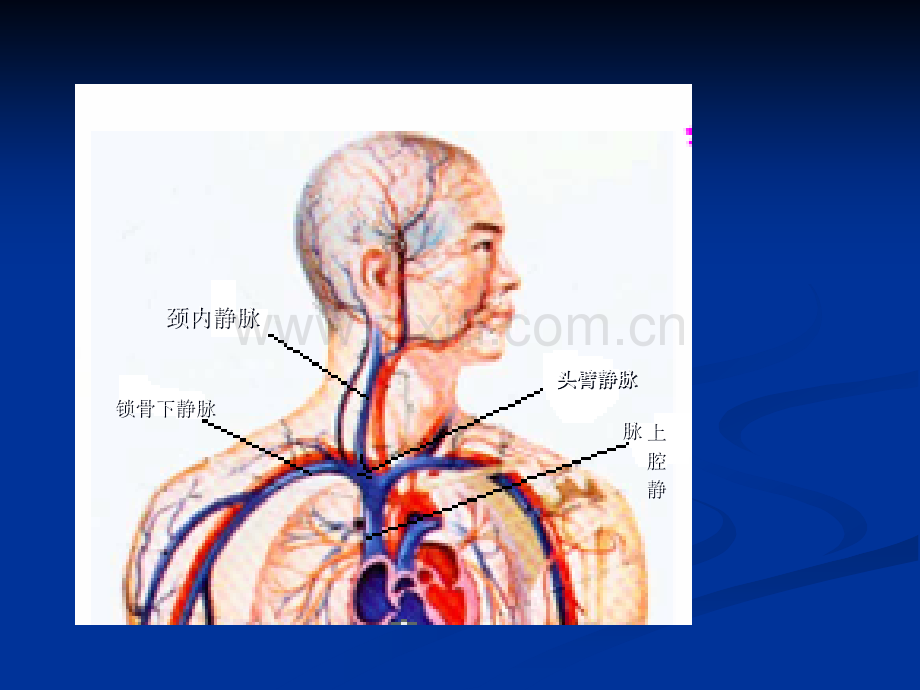 静脉炎的预防与处理.ppt_第3页