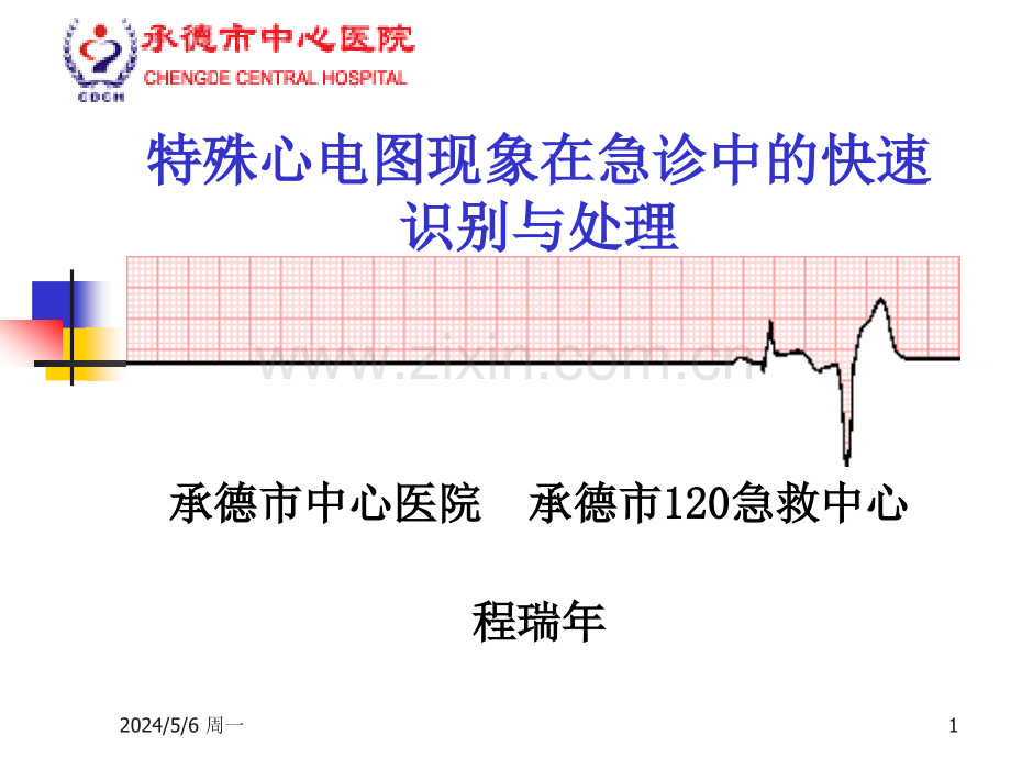 特殊心电图现象在急诊中的快速识别与处理.ppt_第1页