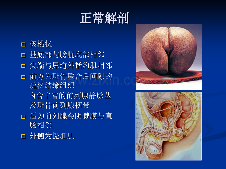 前列腺疾病诊断.ppt_第3页