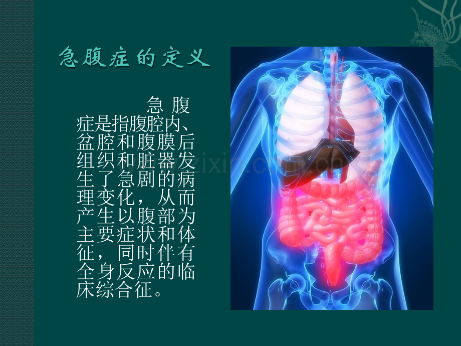 急腹症的影像表现.pptx_第2页