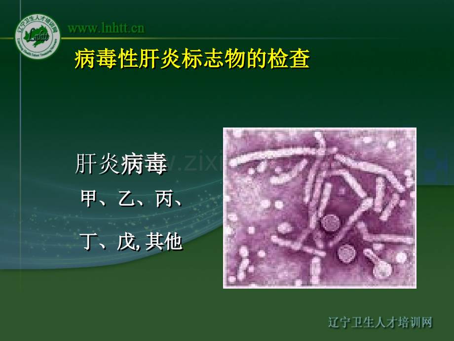 临床意义2乙肝病毒表面抗体Anti-HBs.ppt_第3页