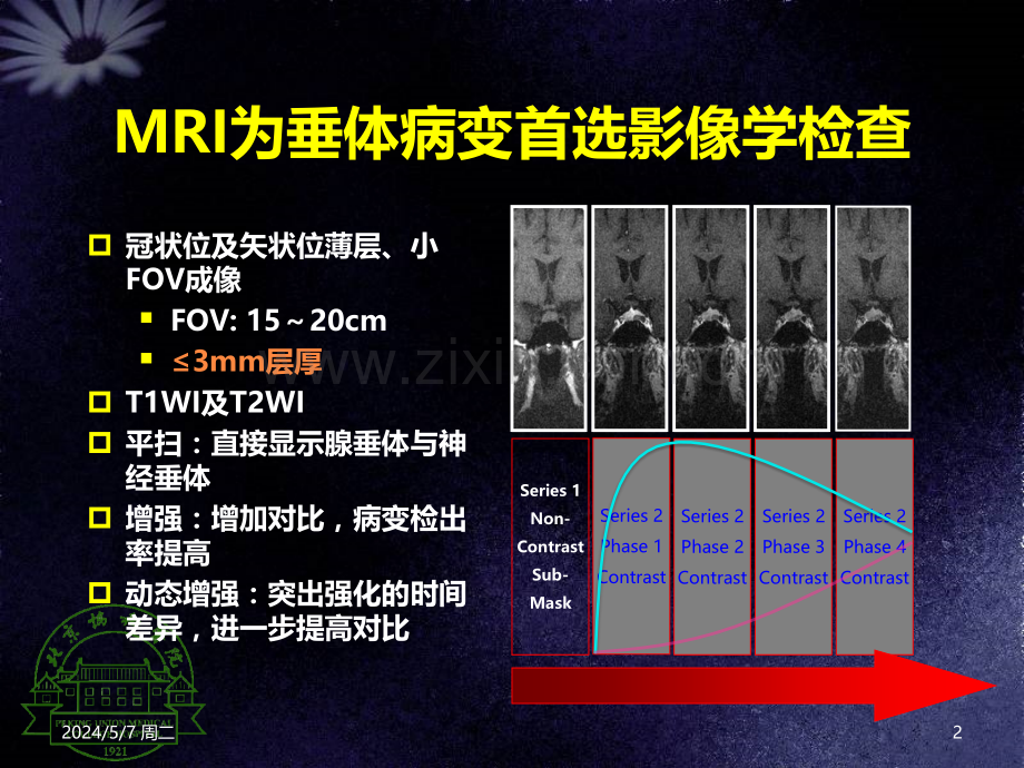 垂体病变MRI诊断思路.ppt_第2页