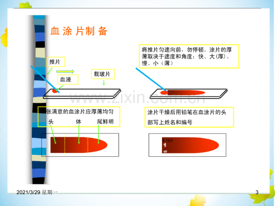 血涂片制作与染色.ppt_第3页