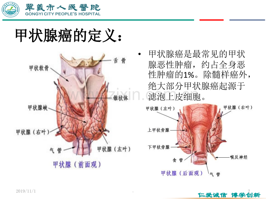 甲状腺癌教学查房胸心外科.ppt_第2页