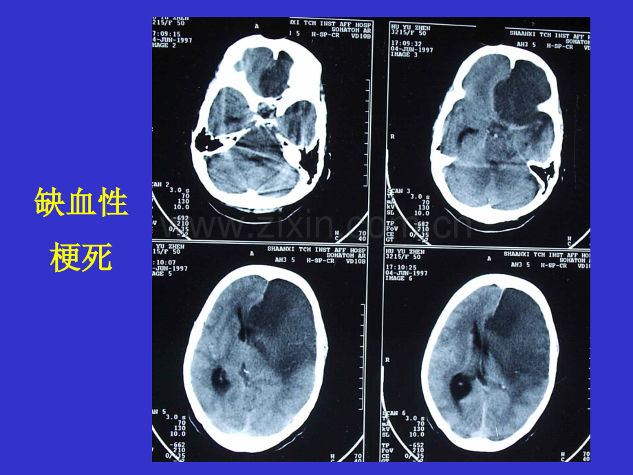 医学影像学颅脑.ppt_第2页