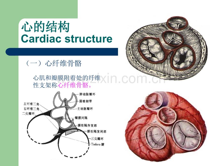 心脏肿瘤CT诊断.ppt_第3页